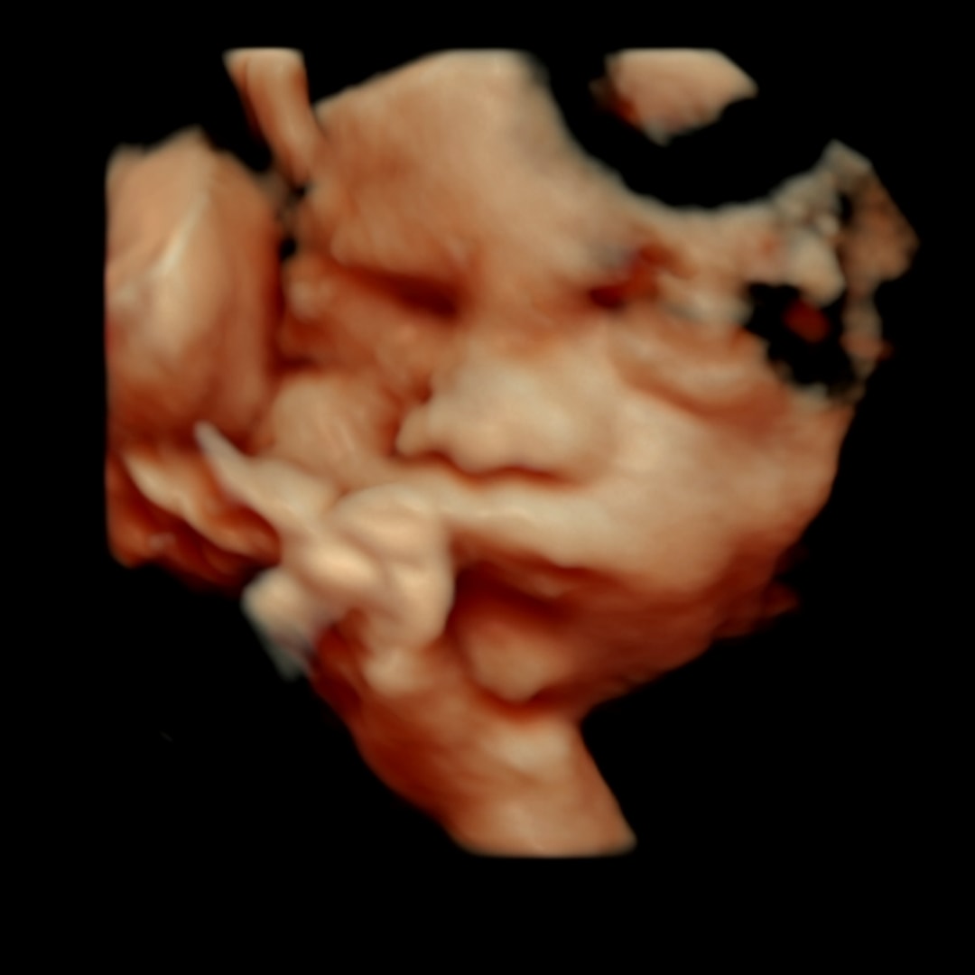 Photo shared by Emily for their Babylist baby registry.