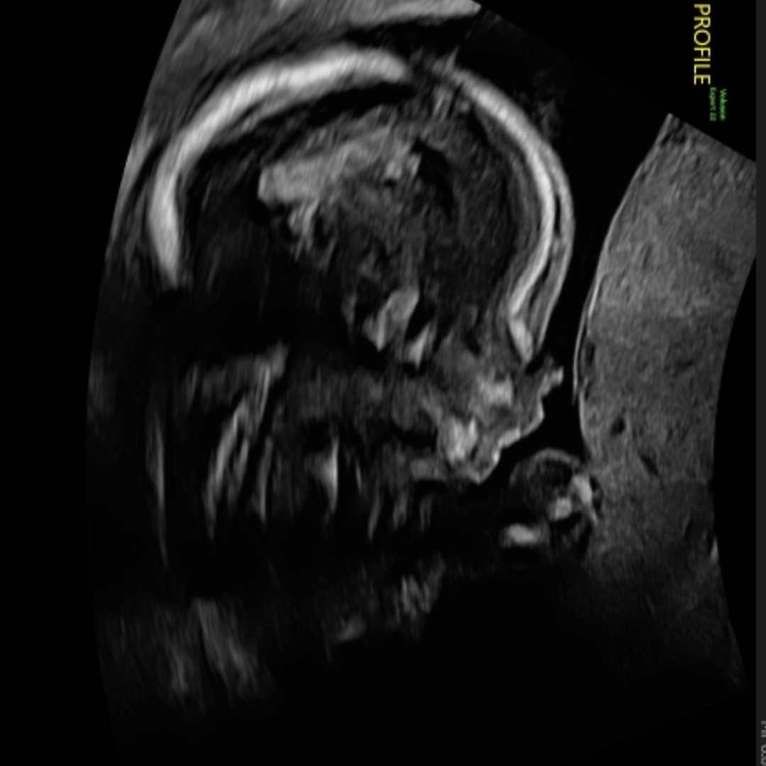 Photo shared by Hazel for their Babylist baby registry.