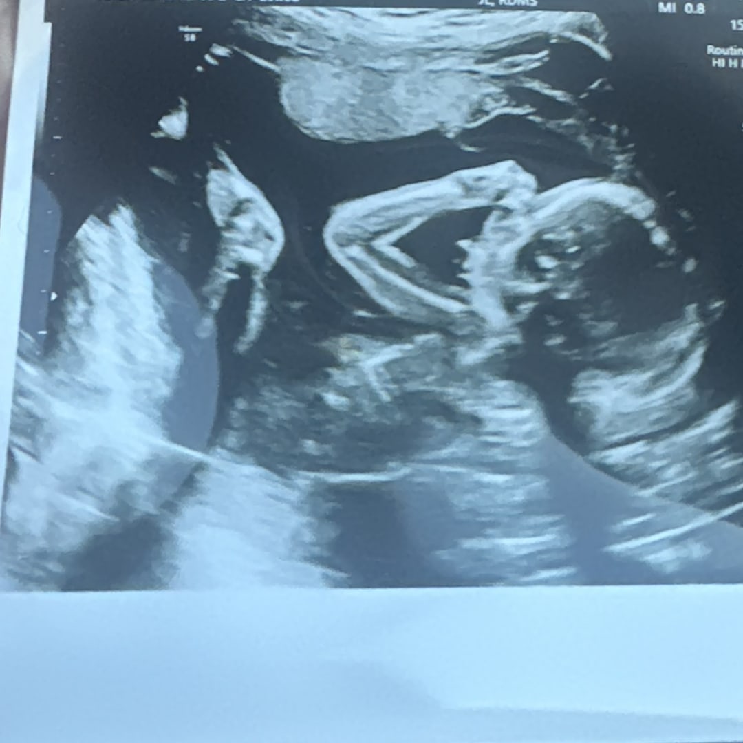 Photo shared by Emily for their Babylist baby registry.