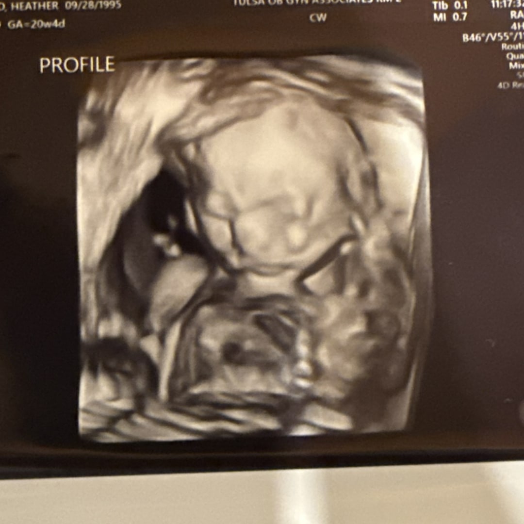 Photo shared by Heather for their Babylist baby registry.