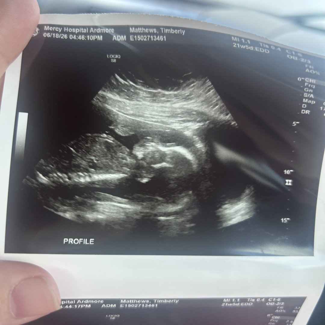 Photo shared by Timberly for their Babylist baby registry.