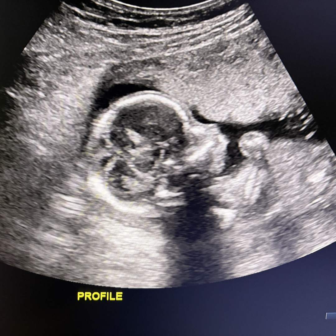 Photo shared by Hannah for their Babylist baby registry.