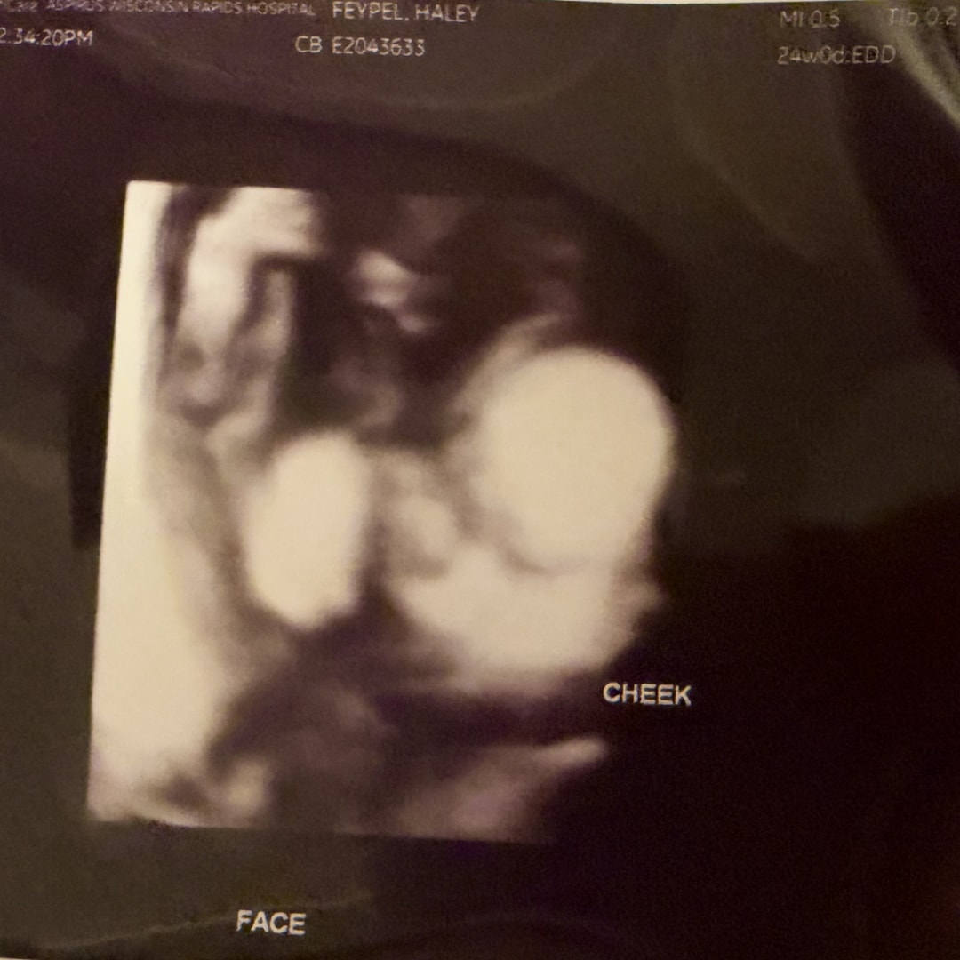 Photo shared by Haley for their Babylist baby registry.