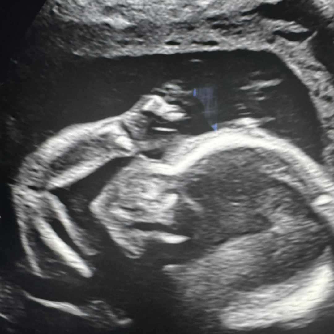 Photo shared by Tabatha for their Babylist baby registry.