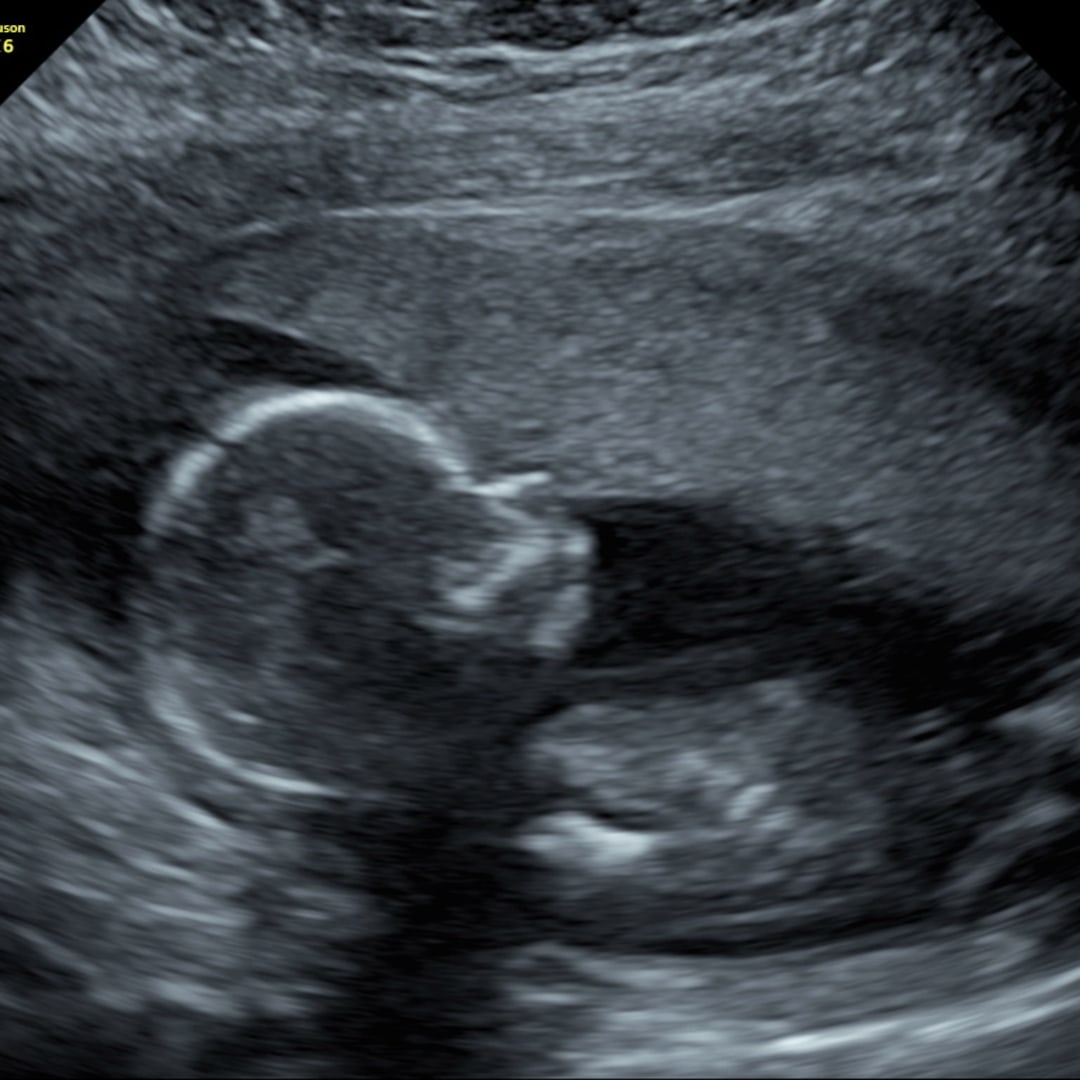 Photo shared by Sara for their Babylist baby registry.