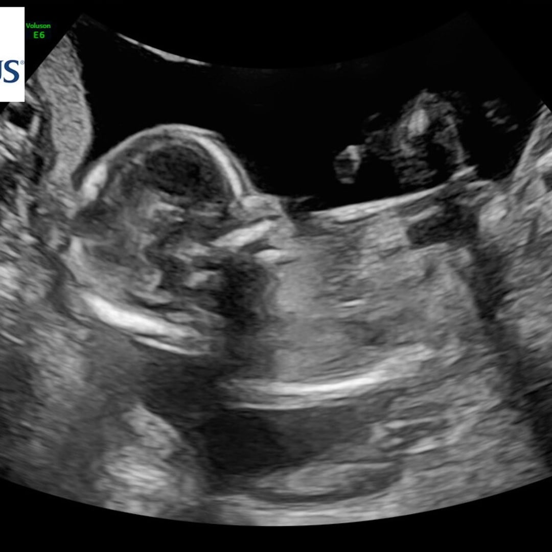 Photo shared by Sydney for their Babylist baby registry.