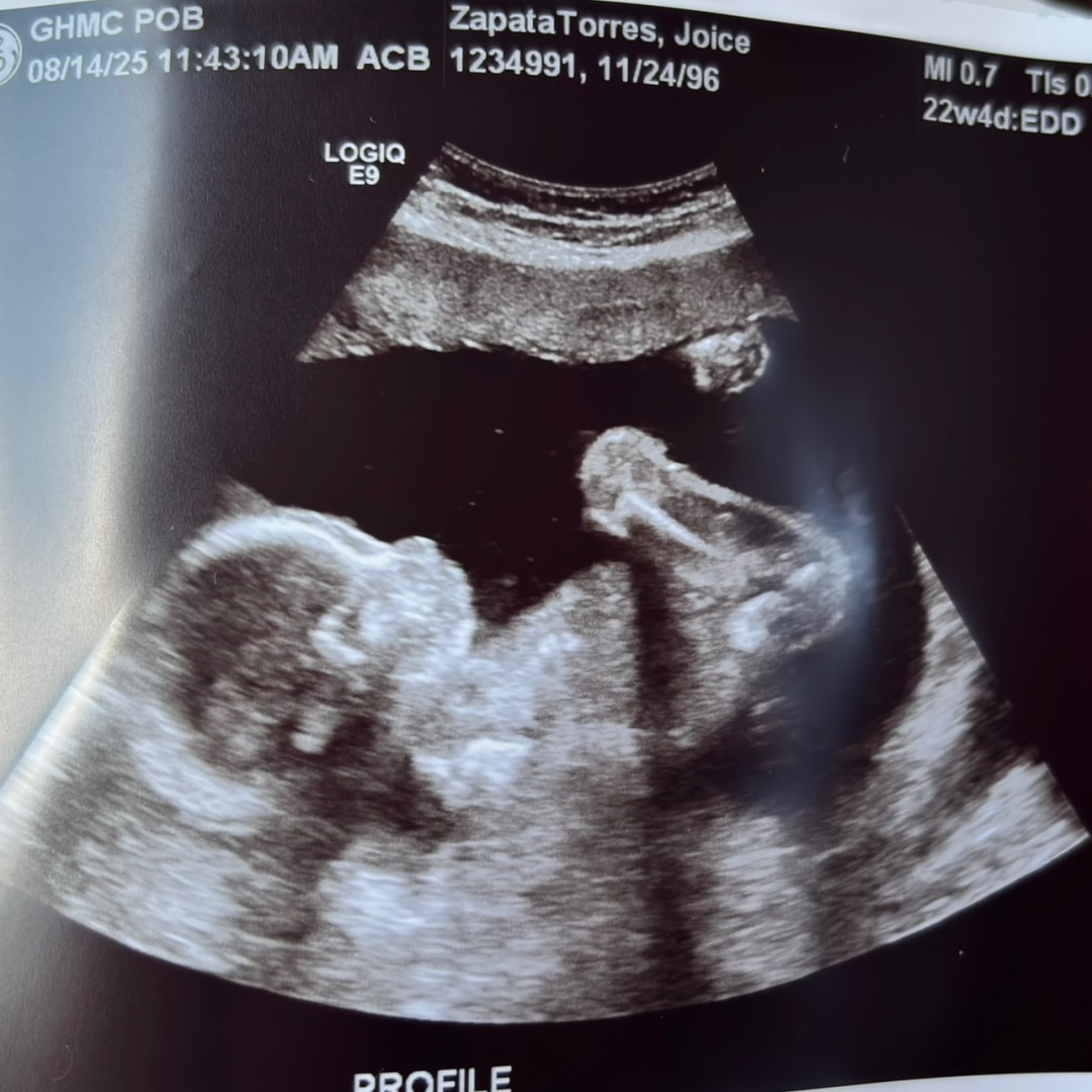 Photo shared by Joice for their Babylist baby registry.