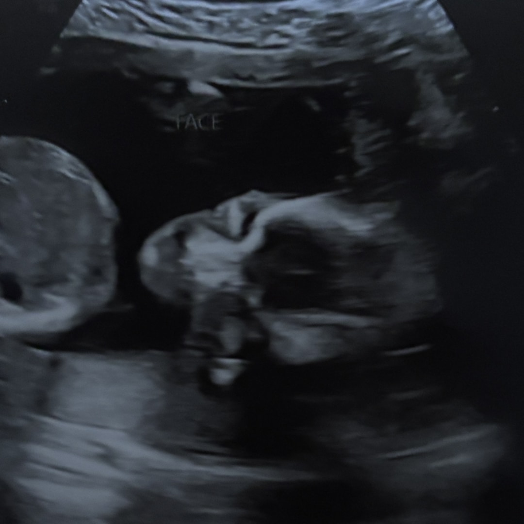 Photo shared by Andeisha for their Babylist baby registry.