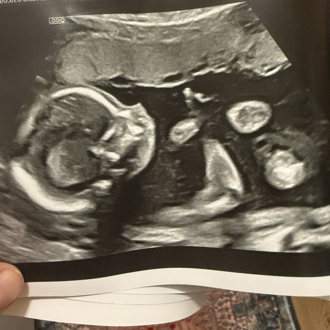 Photo shared by Hailie for their Babylist baby registry.
