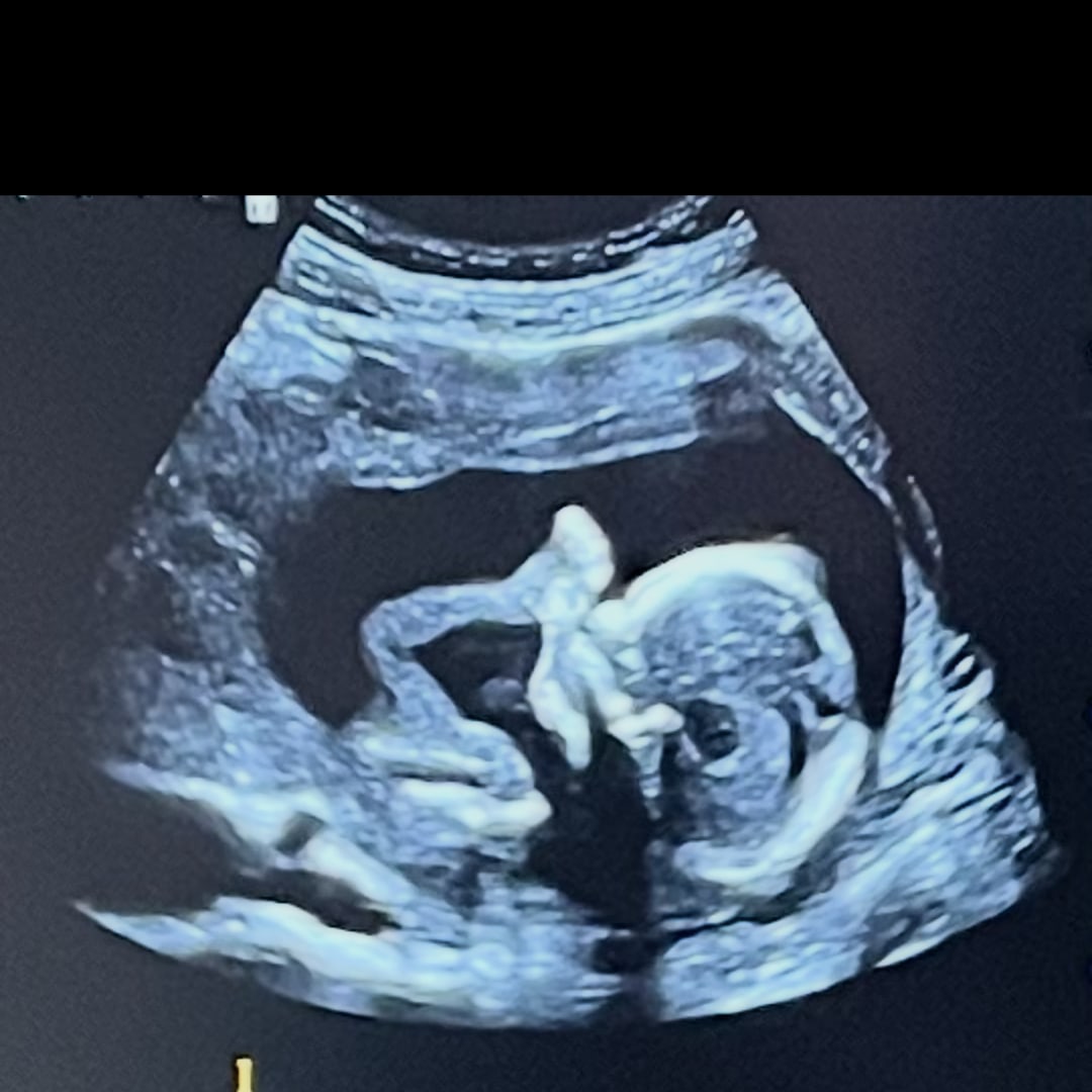 Photo shared by Emma for their Babylist baby registry.