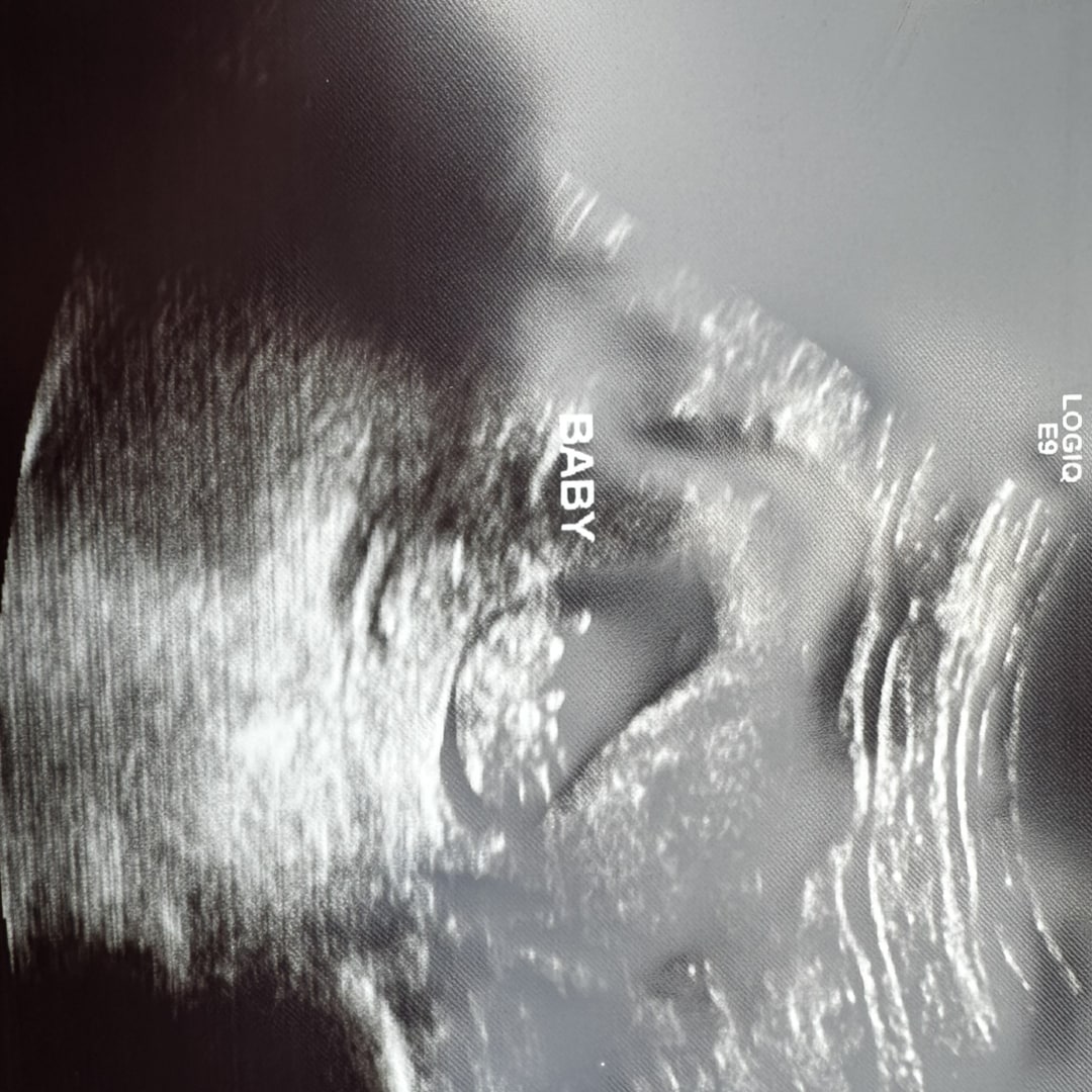 Photo shared by Francisco for their Babylist baby registry.