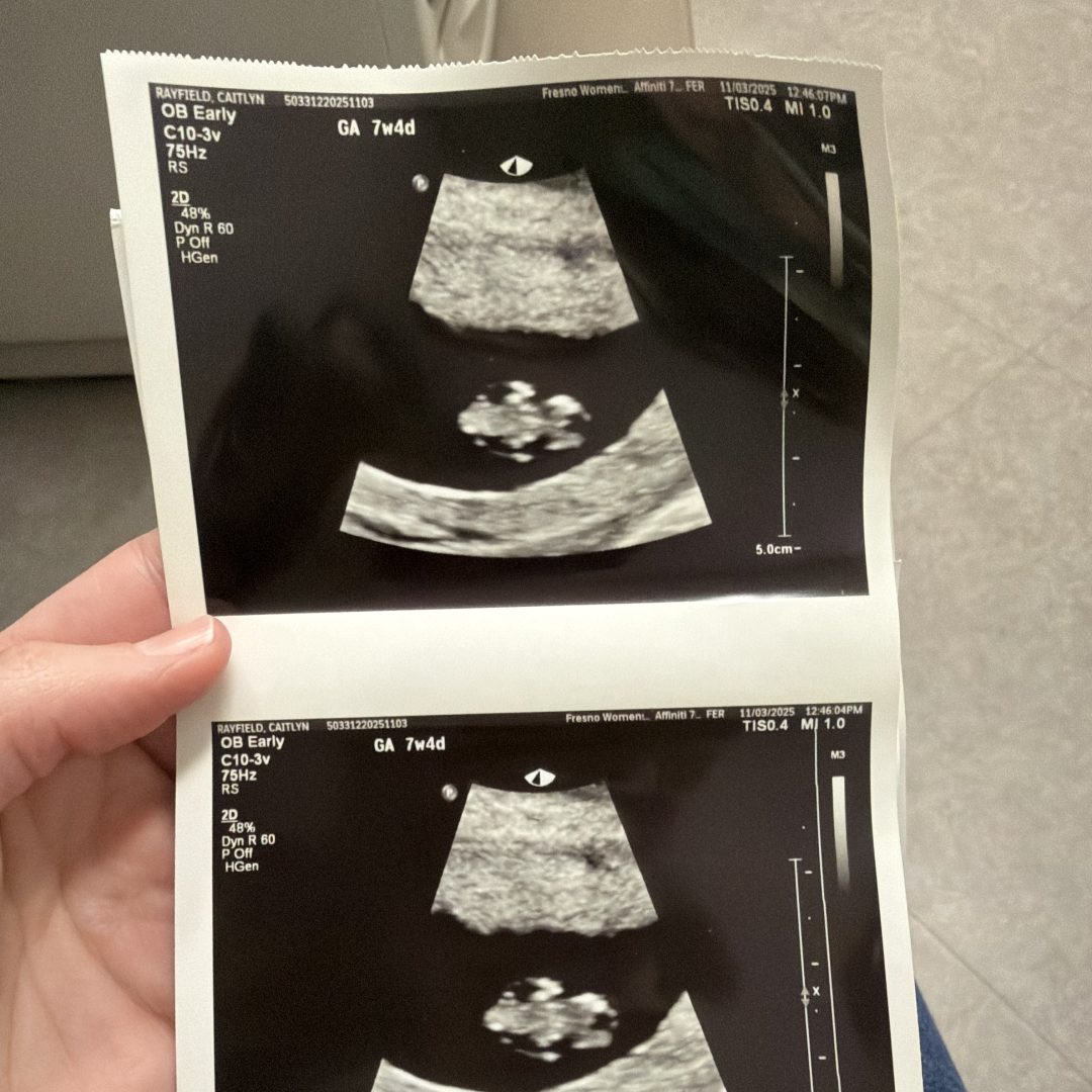 Photo shared by Caitlyn for their Babylist baby registry.