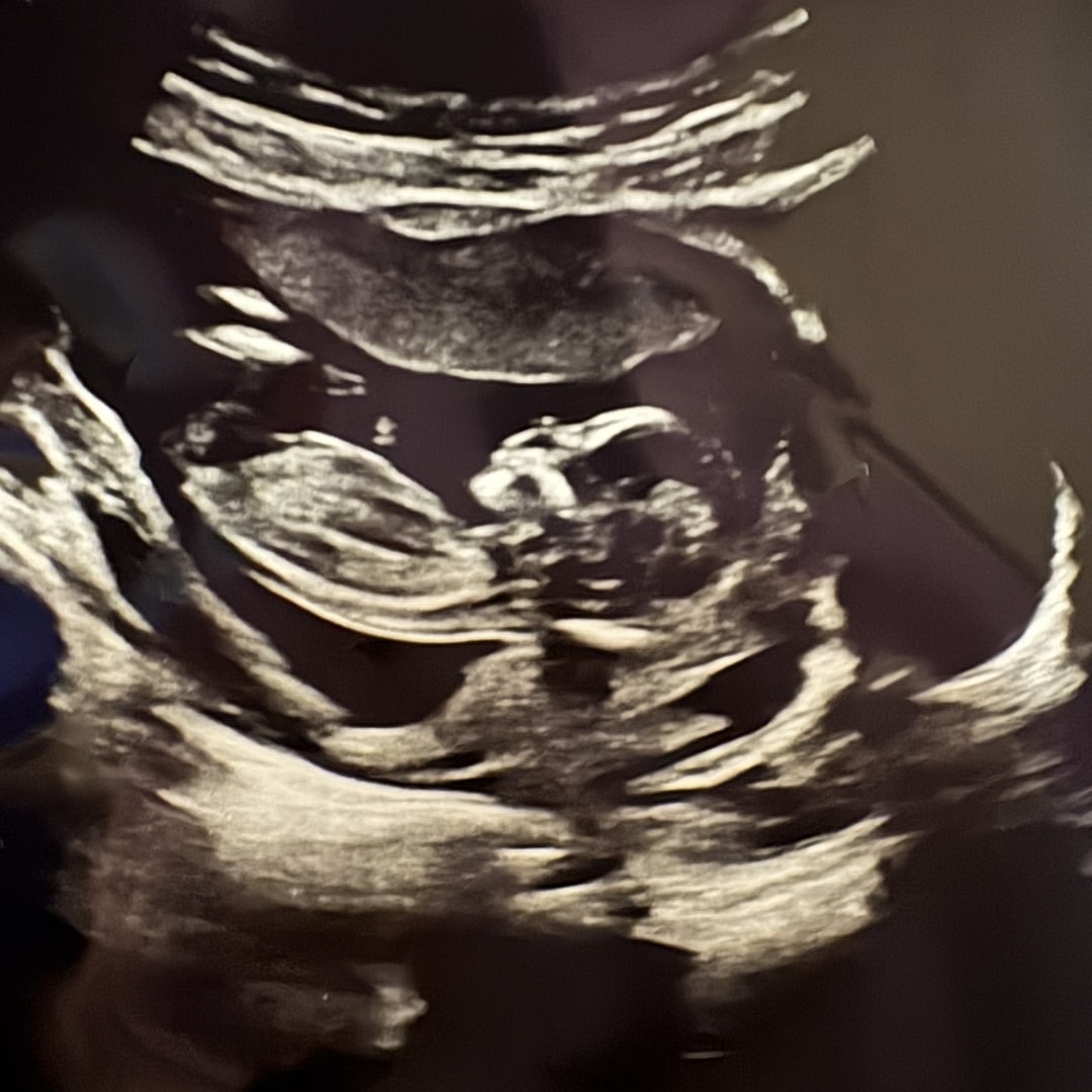 Photo shared by Jenna for their Babylist baby registry.