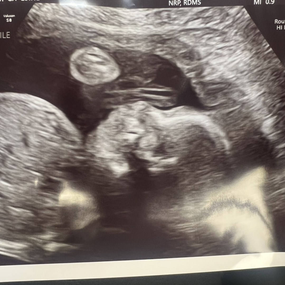 Photo shared by Brittany for their Babylist baby registry.
