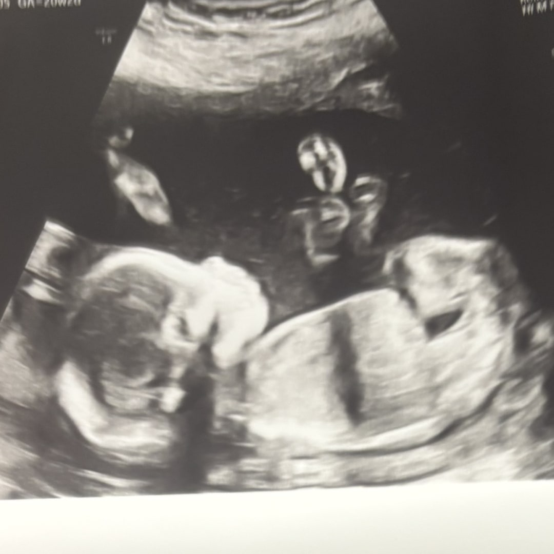 Photo shared by Graycen for their Babylist baby registry.