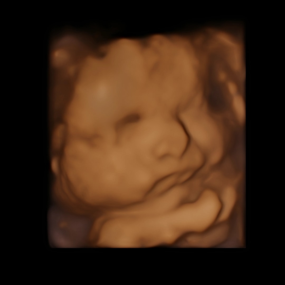 Photo shared by Rachel for their Babylist baby registry.
