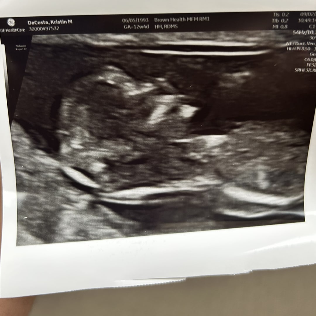 Photo shared by Kristin for their Babylist baby registry.