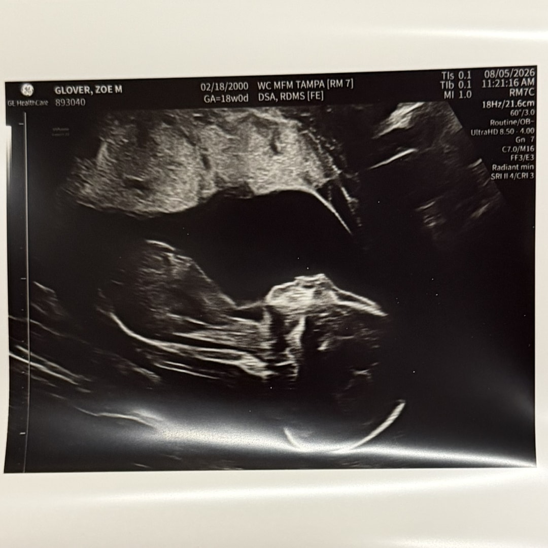 Photo shared by Zoe for their Babylist baby registry.