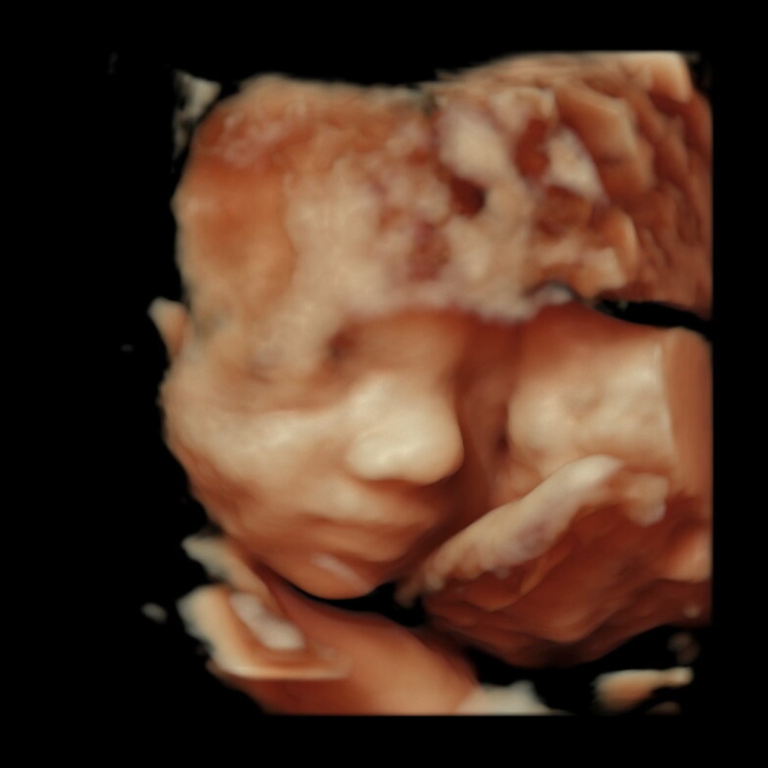 Photo shared by Madison for their Babylist baby registry.