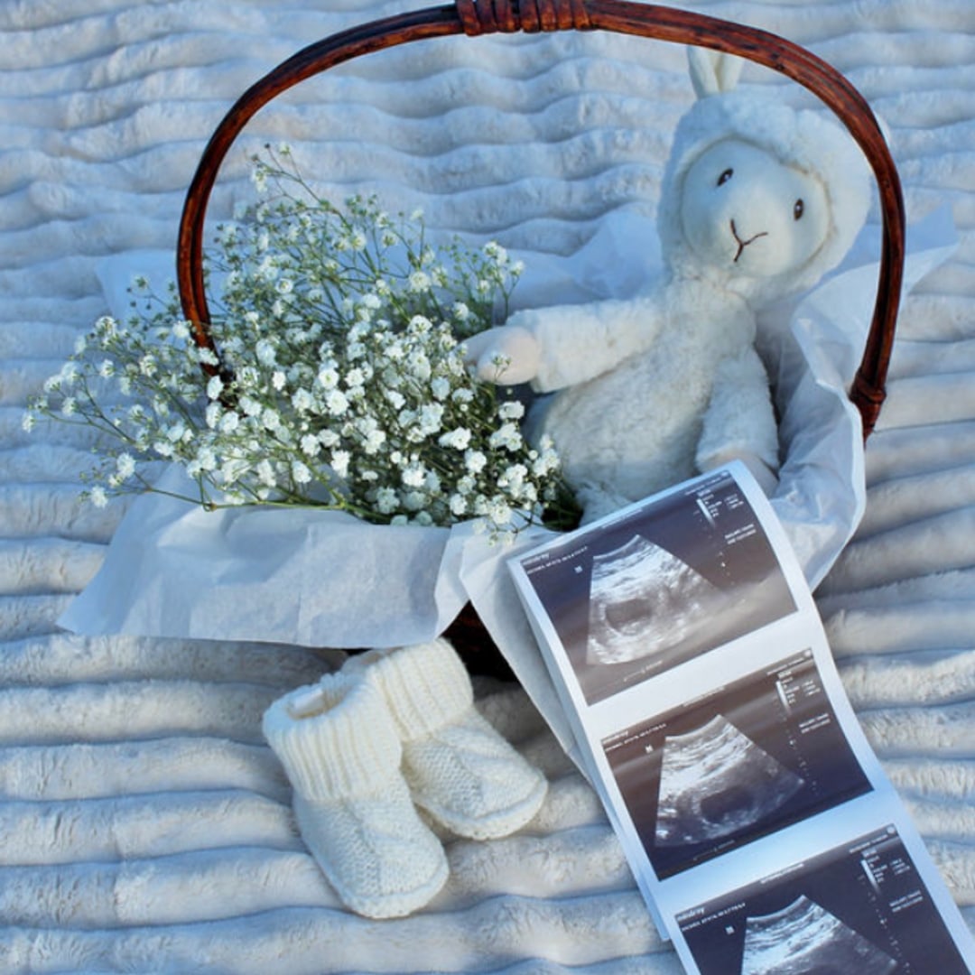 Photo shared by Stephanie for their Babylist baby registry.