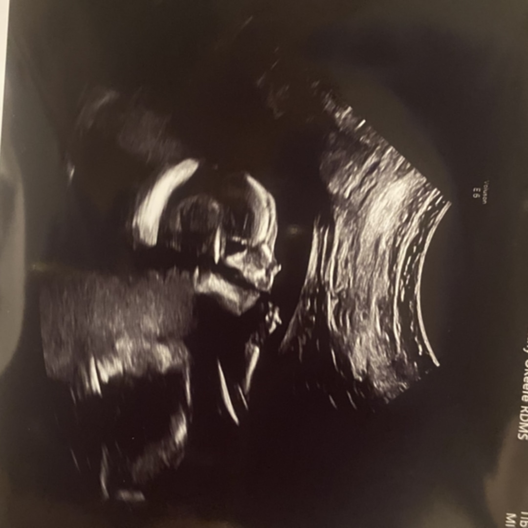 Photo shared by Chandler for their Babylist baby registry.