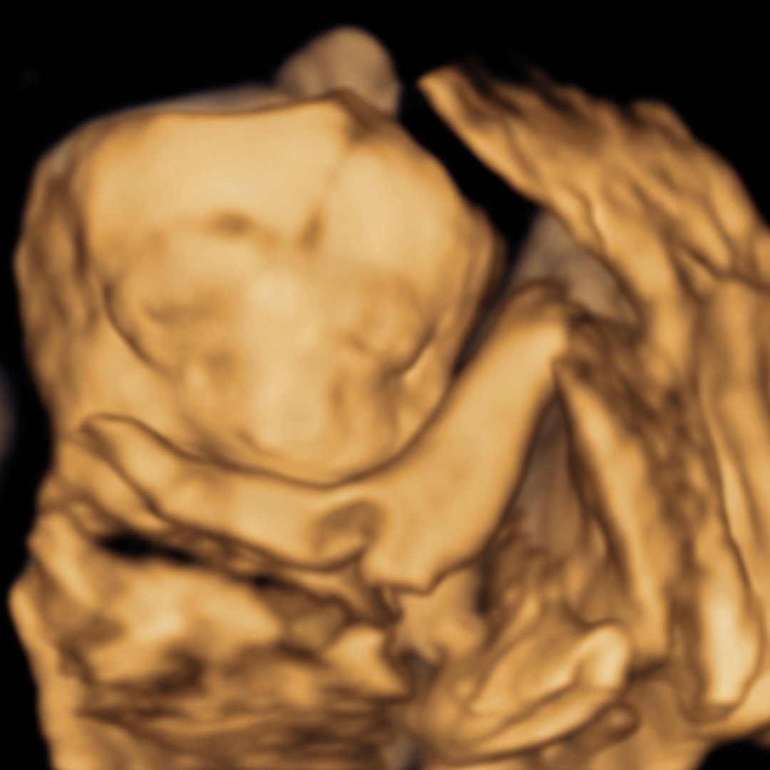 Photo shared by Henieta for their Babylist baby registry.