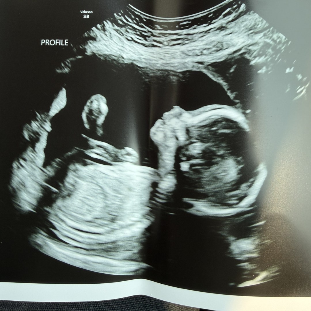 Photo shared by Amarie for their Babylist baby registry.