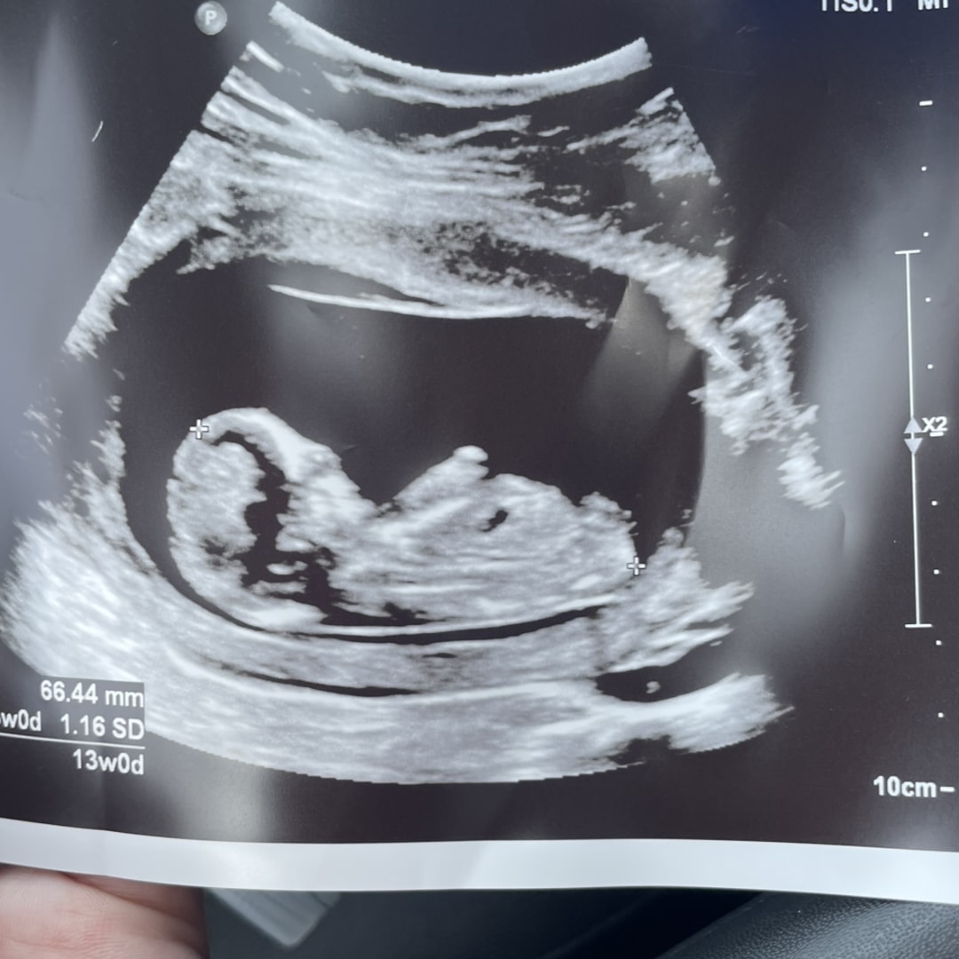 Photo shared by Chelsea for their Babylist baby registry.