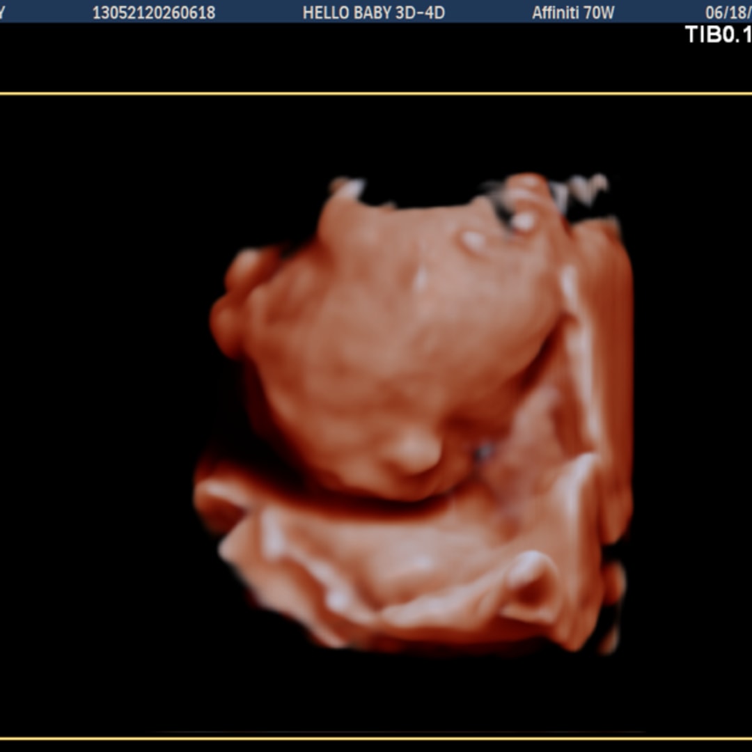 Photo shared by Trinity for their Babylist baby registry.