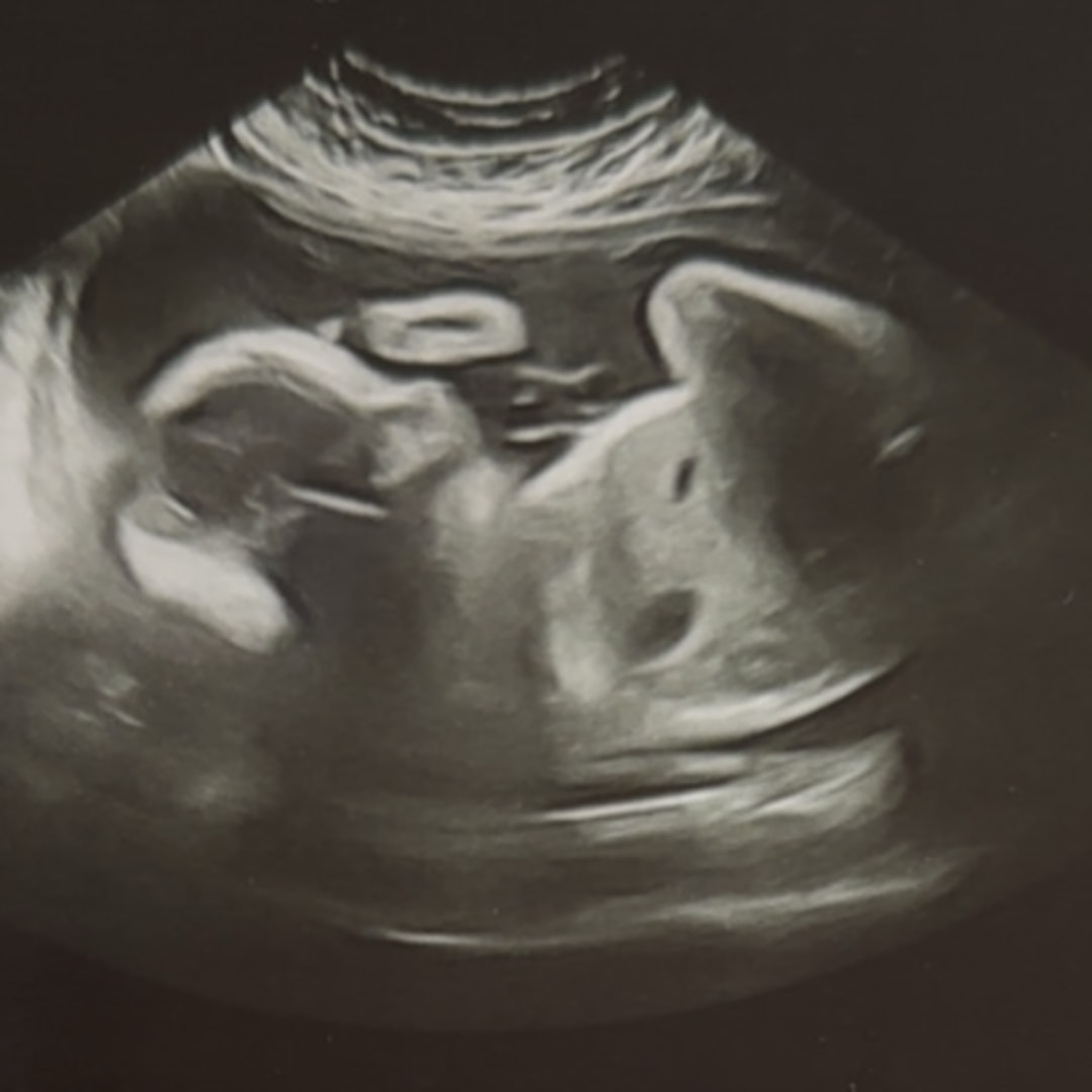 Photo shared by Kyleigh for their Babylist baby registry.