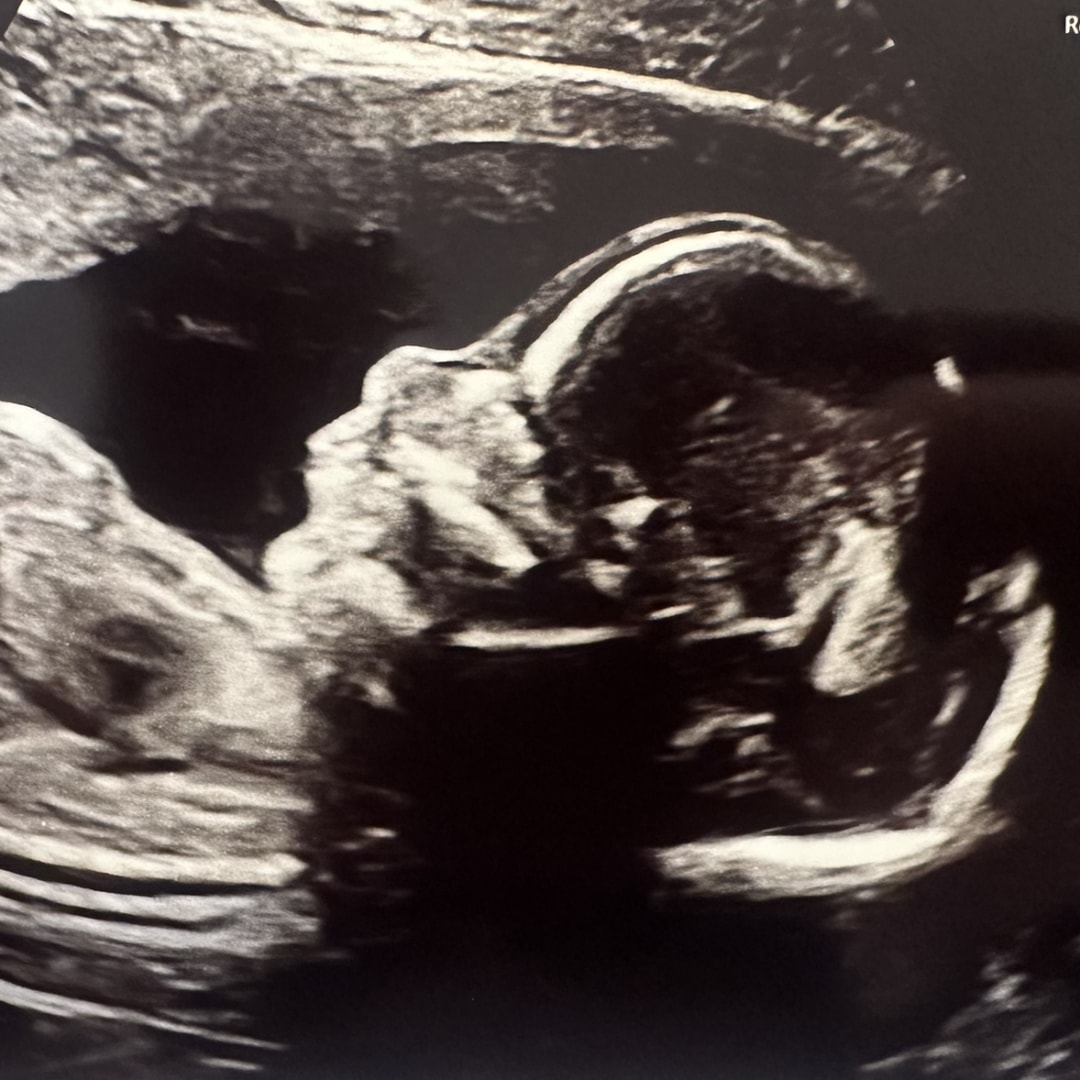 Photo shared by Morgan for their Babylist baby registry.