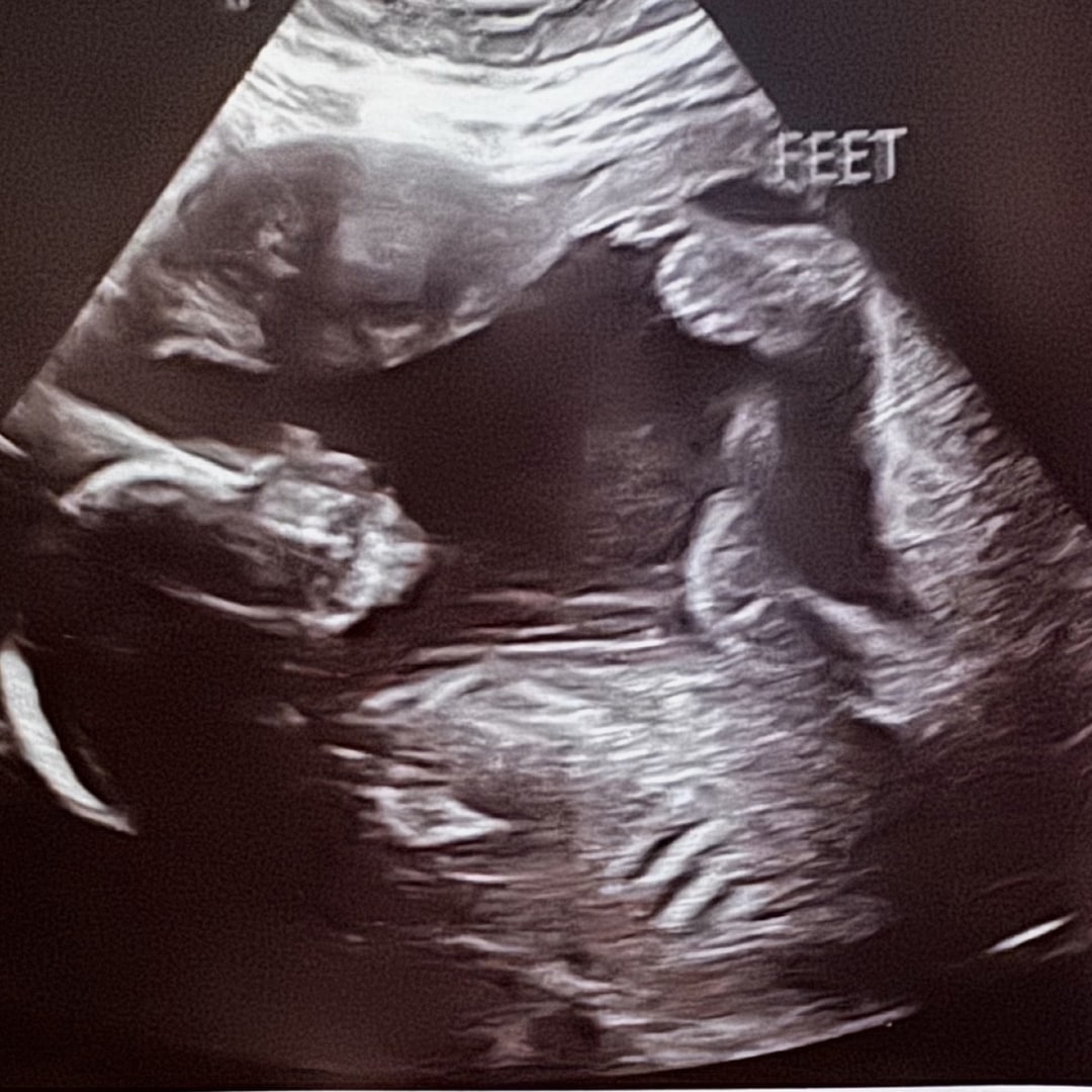 Photo shared by Monica for their Babylist baby registry.
