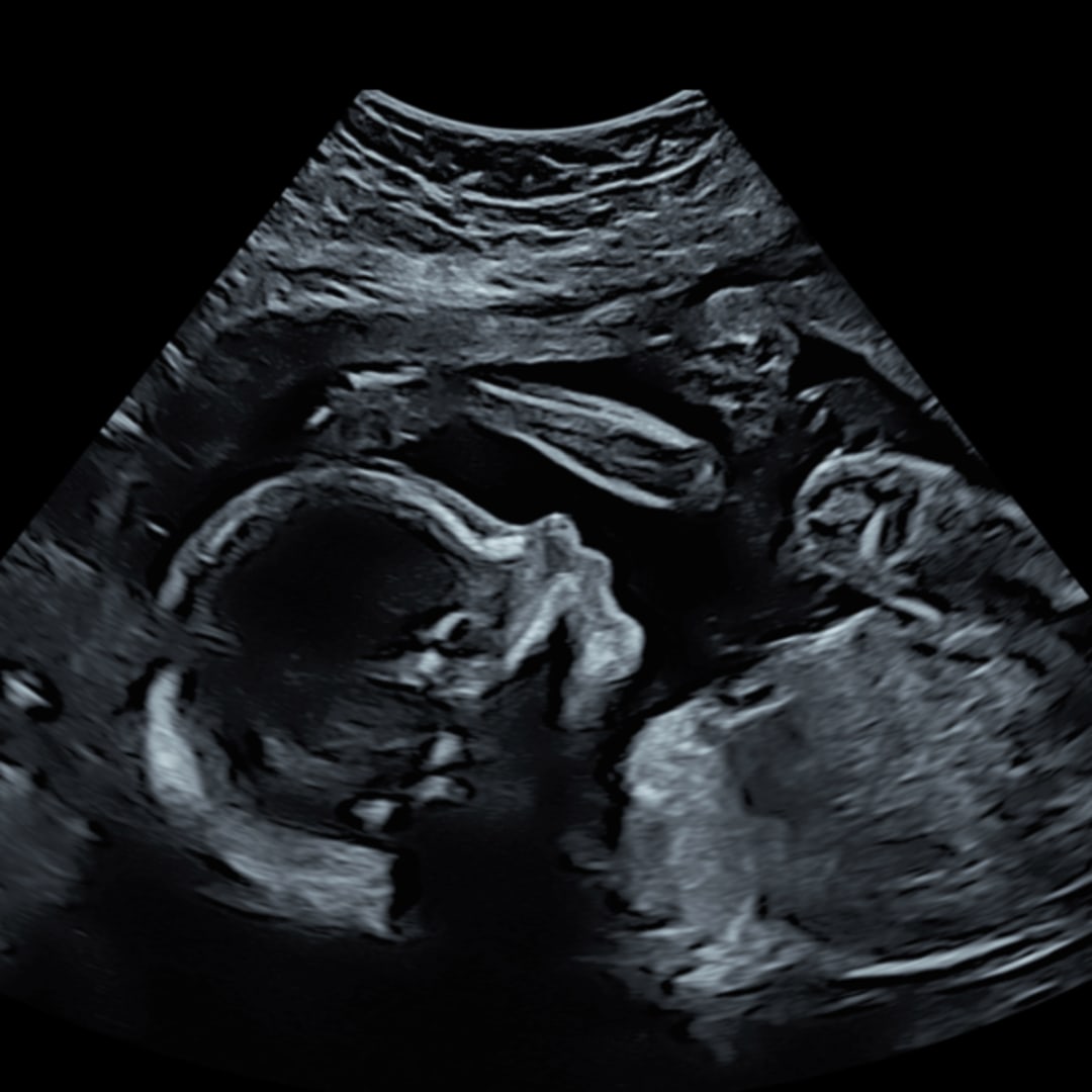 Photo shared by Abigail for their Babylist baby registry.