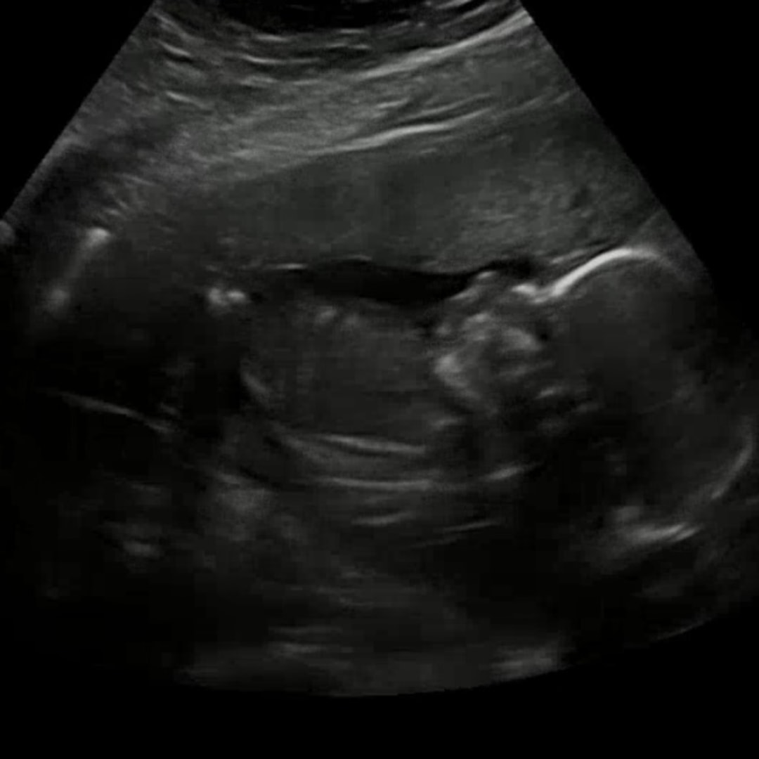 Photo shared by Alex for their Babylist baby registry.