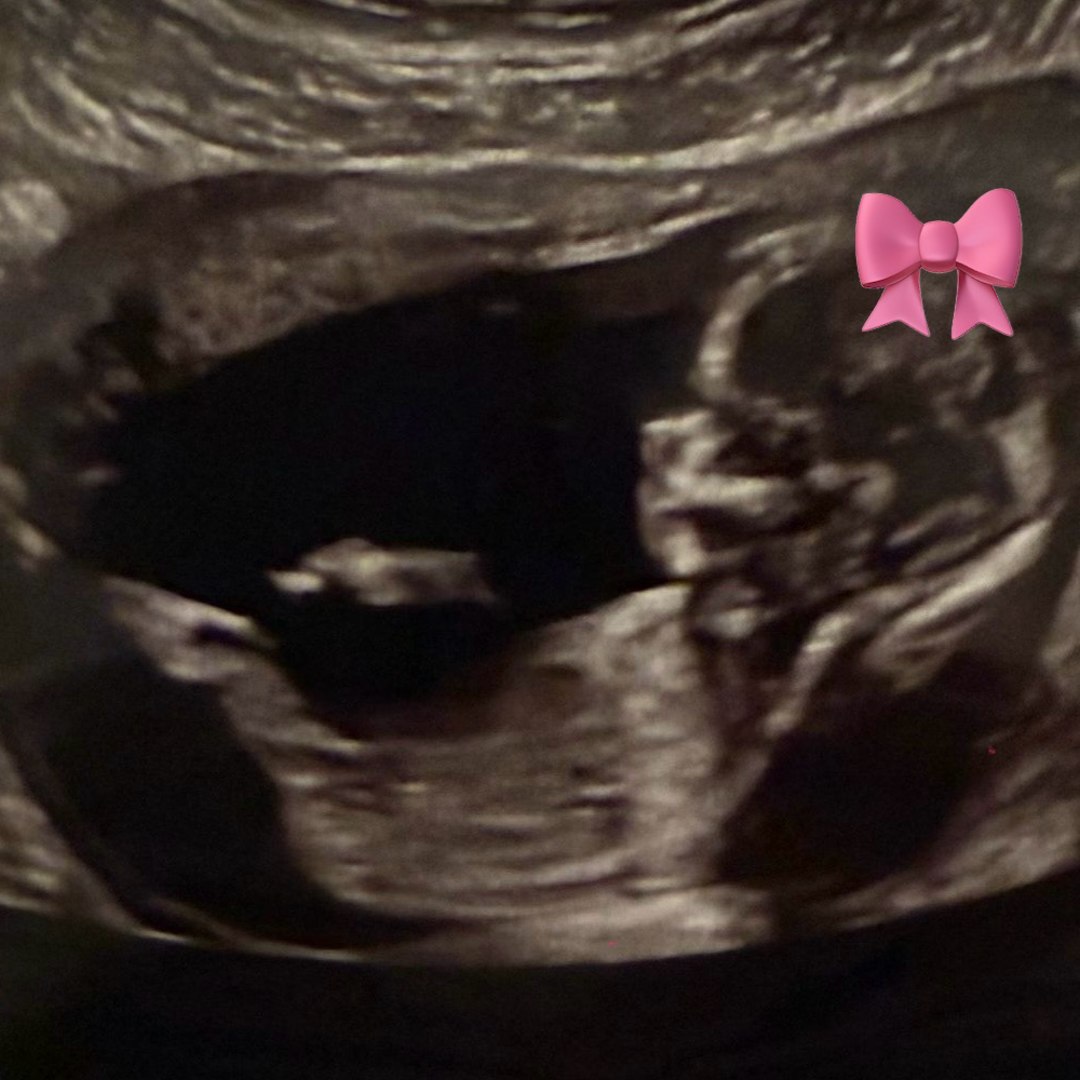 Photo shared by Estefania for their Babylist baby registry.
