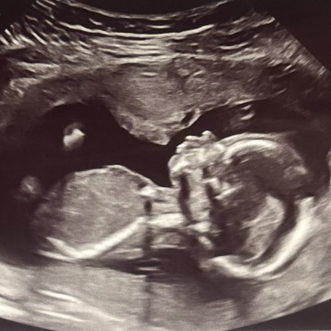 Photo shared by Caroline for their Babylist baby registry.