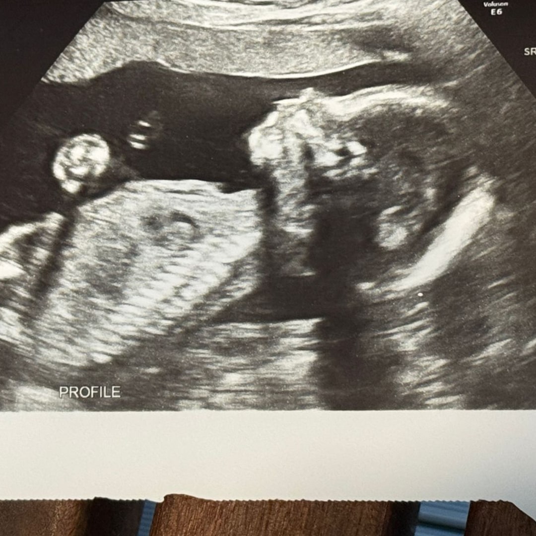 Photo shared by Mukarram for their Babylist baby registry.