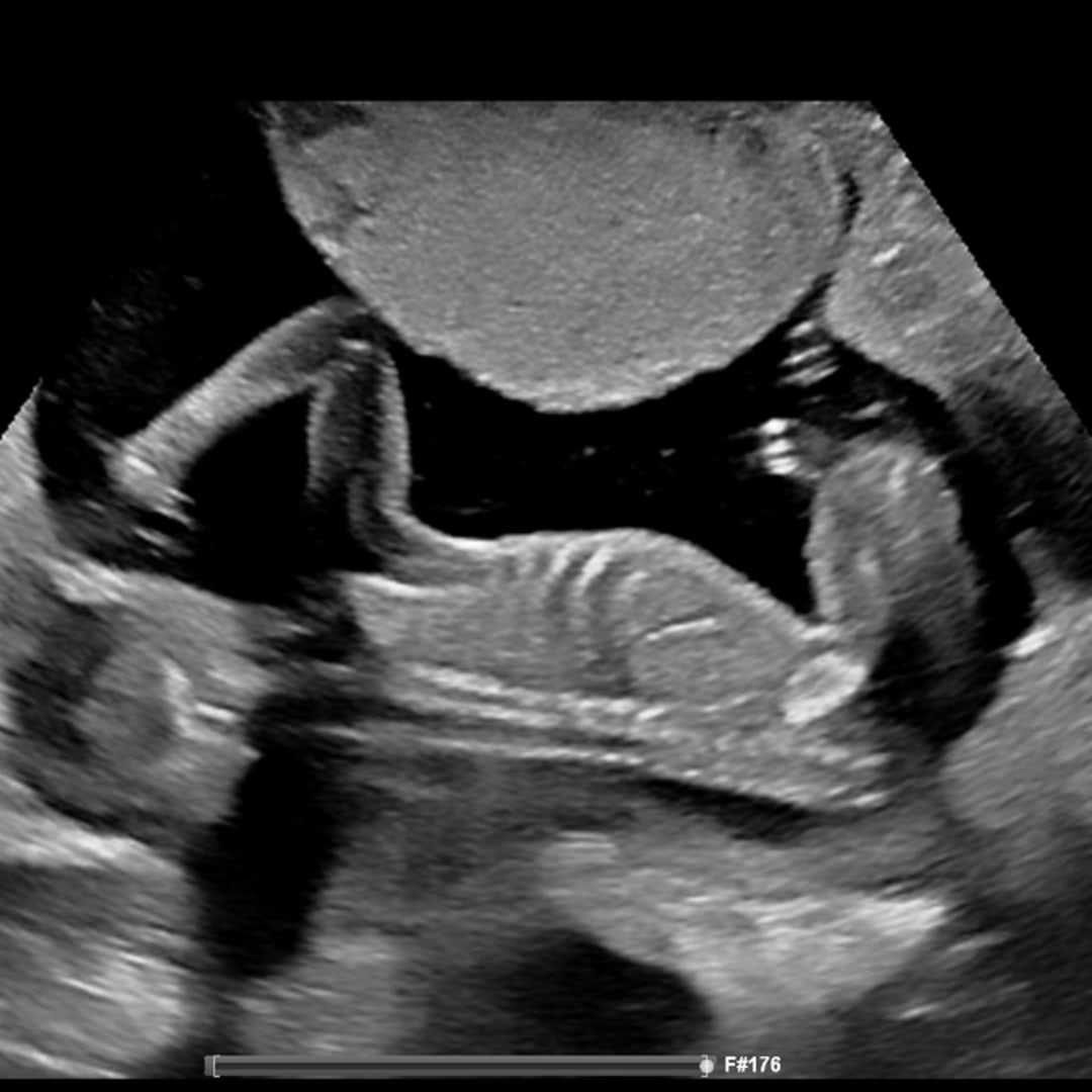 Photo shared by Kalli for their Babylist baby registry.