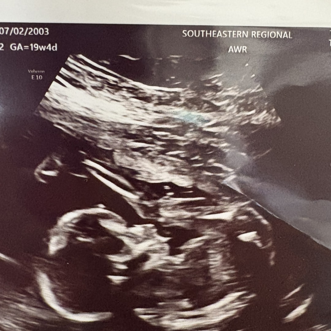 Photo shared by Cara Beth for their Babylist baby registry.