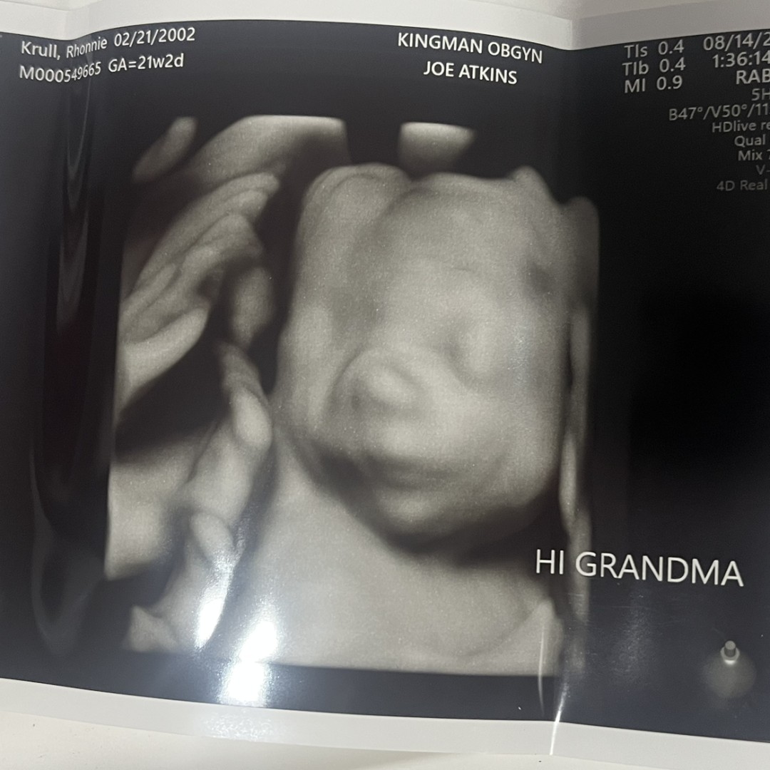 Photo shared by Rhonnie for their Babylist baby registry.