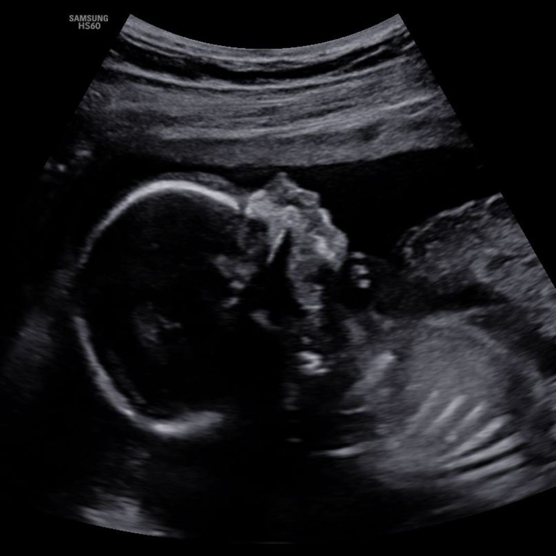 Photo shared by Chanel for their Babylist baby registry.