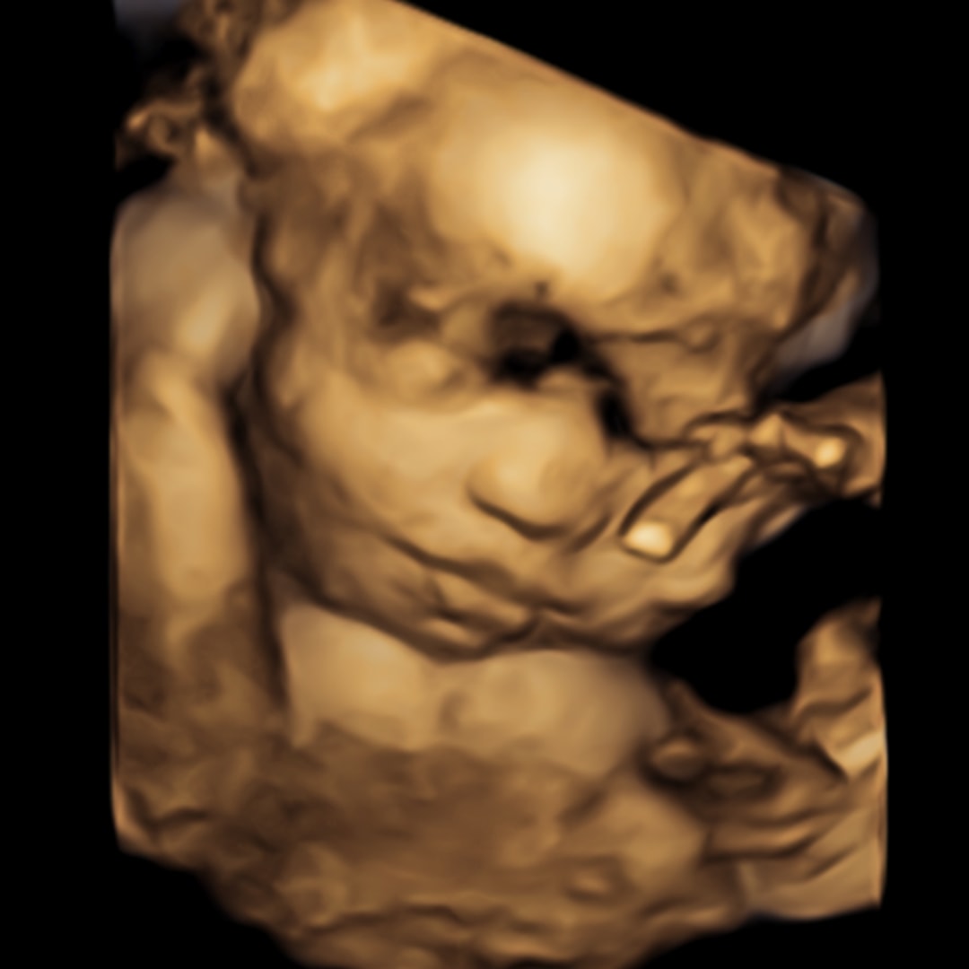 Photo shared by Brittney for their Babylist baby registry.