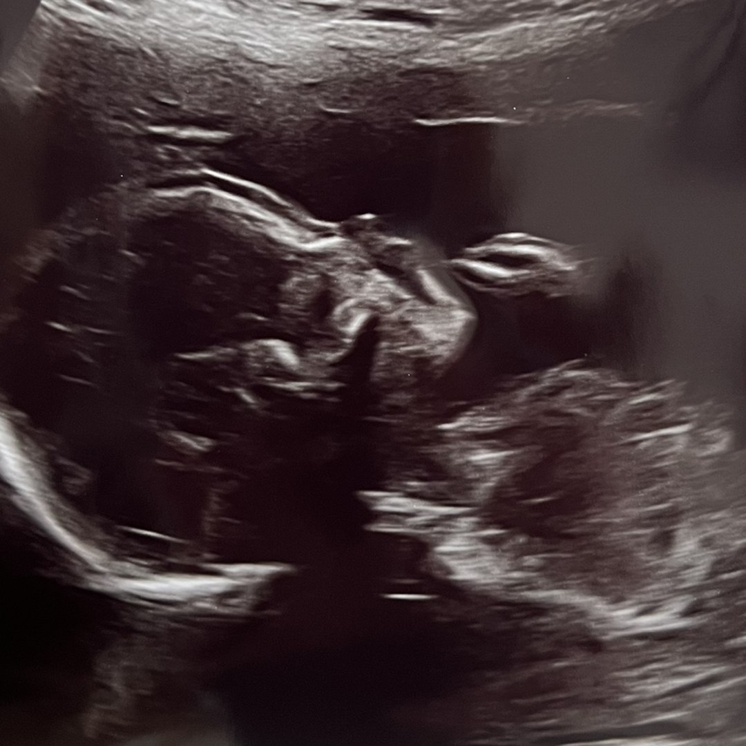 Photo shared by Alisia for their Babylist baby registry.