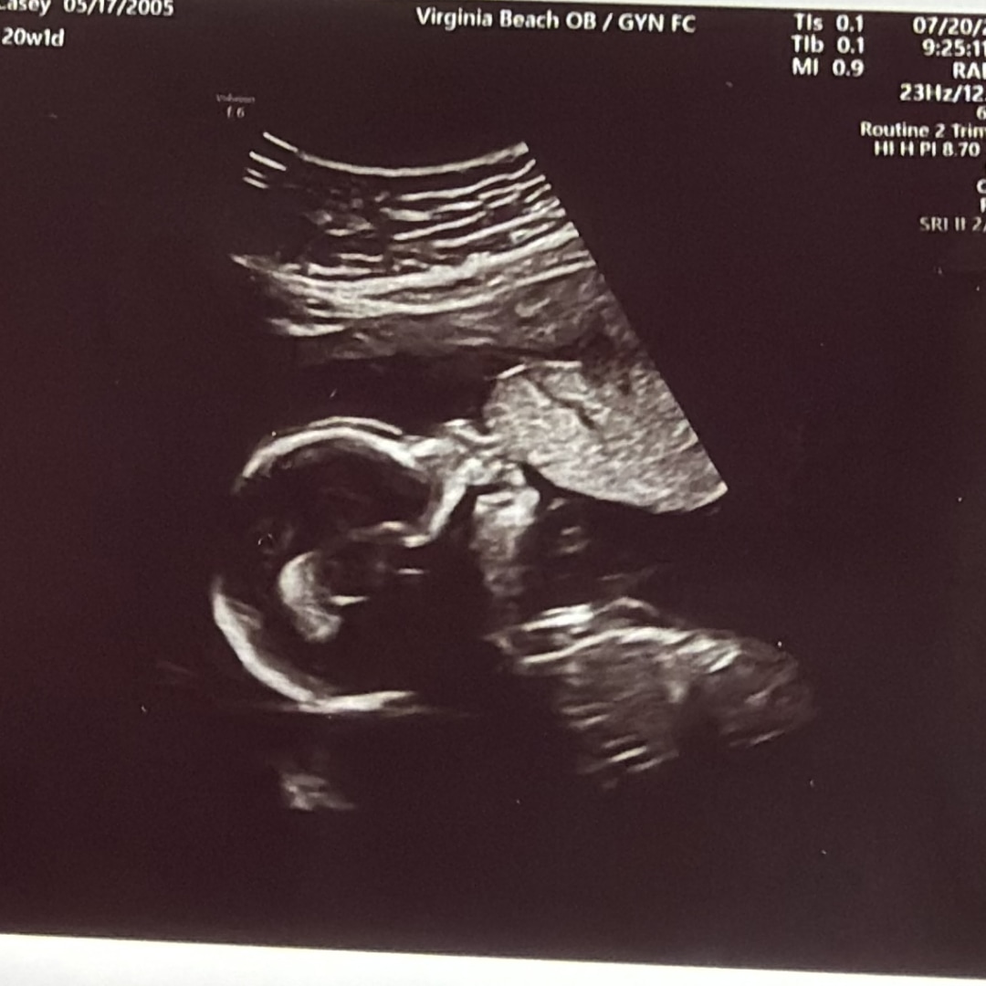 Photo shared by Casey for their Babylist baby registry.