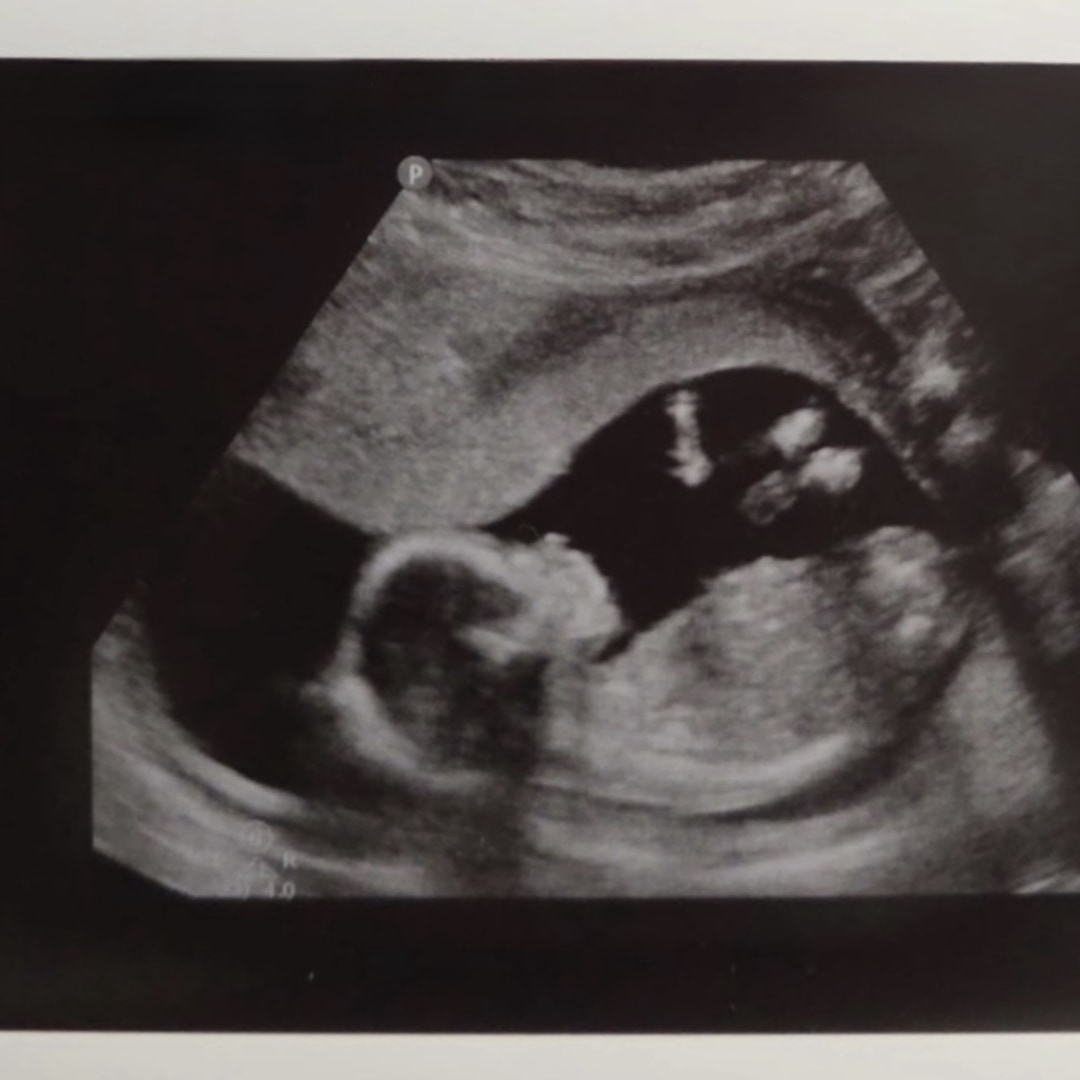 Photo shared by Lauren for their Babylist baby registry.