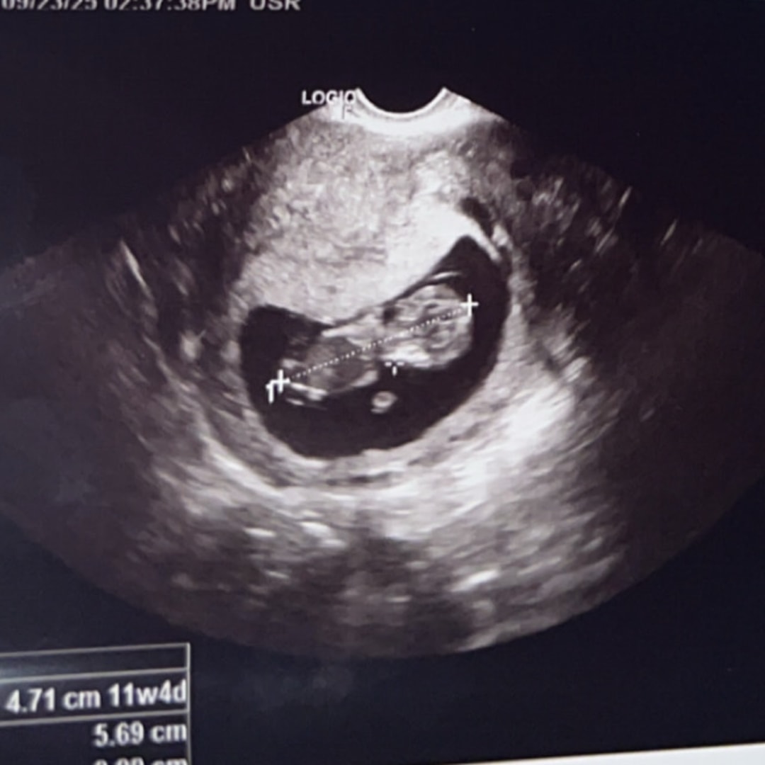 Photo shared by Electa for their Babylist baby registry.