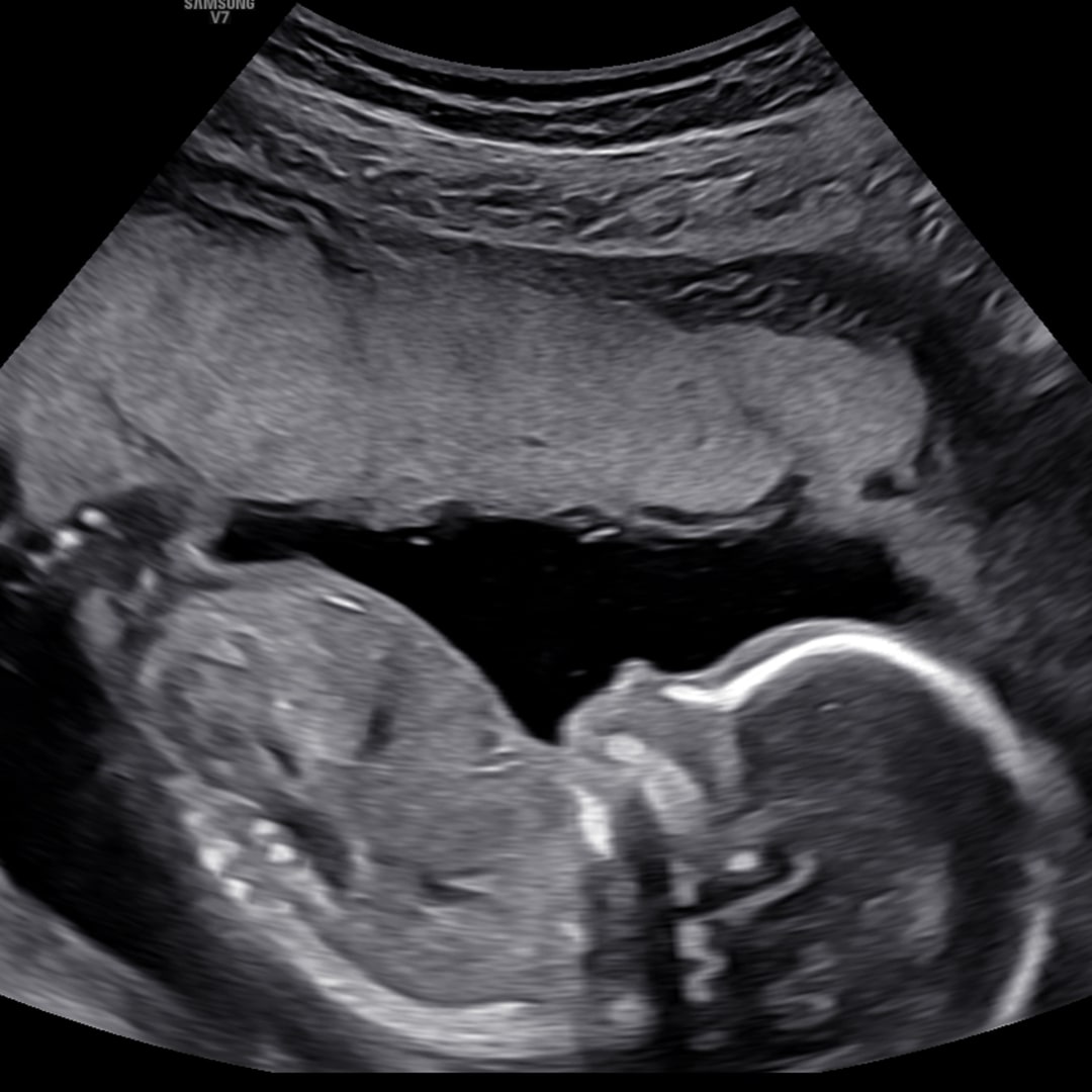 Photo shared by Hannah for their Babylist baby registry.