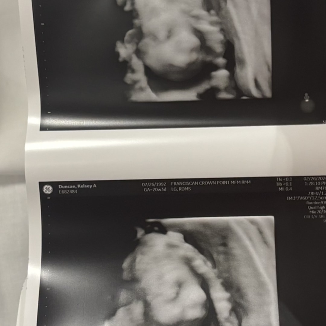 Photo shared by Kelsey for their Babylist baby registry.