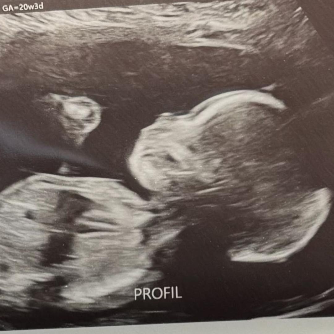 Photo shared by Sanjuana for their Babylist baby registry.