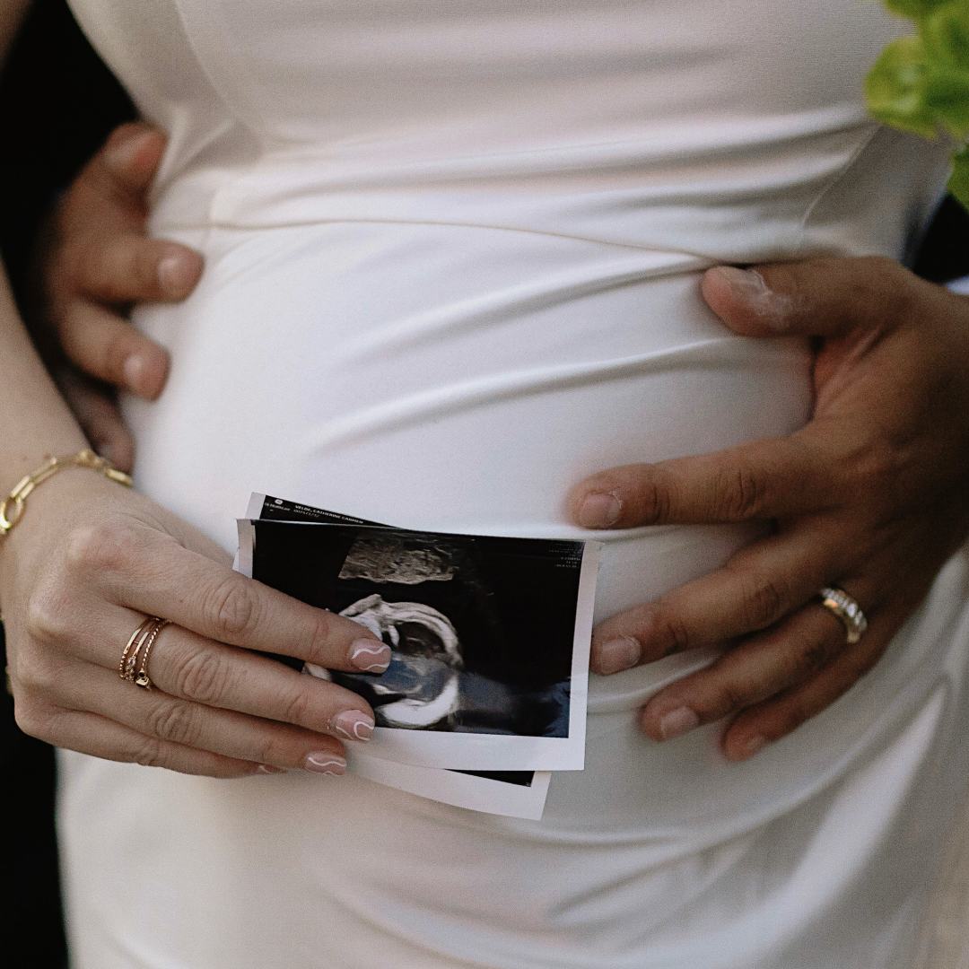 Photo shared by Cat for their Babylist baby registry.